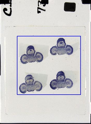 Media type: image; Special Collections 3298   shows specimen_part histological serial section;